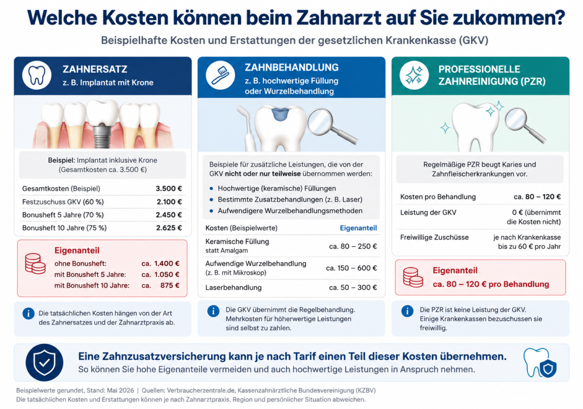 Auflistung zu den möglichen Eigenkosten beim Zahnarzt Auflistung zu den möglichen Eigenkosten beim Zahnarzt